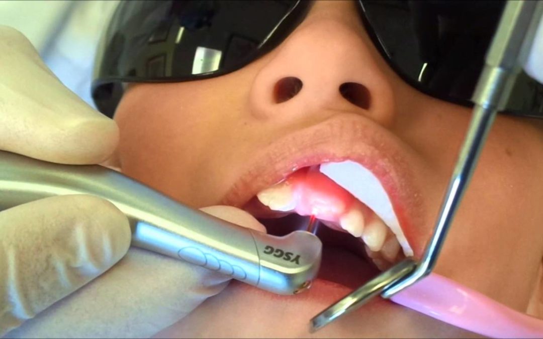 نقش تکنولوژی لیزر در دندانپزشکی