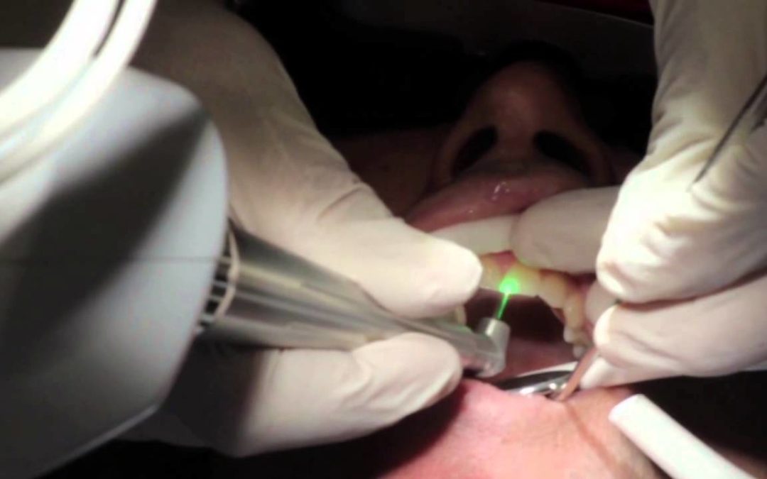 لیزر در دندانپزشکی به چه معنی است؟