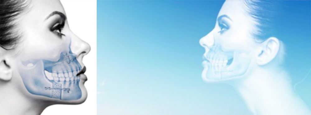 جراحی ارتوگناتیک (جراحی اصلاحی فک) برای چه کسی مناسب است؟